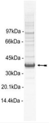 SDS-PAGE (RIPK2-214H).jpg